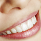 Snap on smile