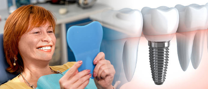 Dental Implants by Dentistry in Scarborough