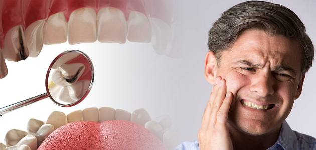 The Low-Down on Secondary Cavities